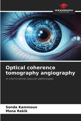 Optical coherence tomography angiography by Kammoun, Sonda