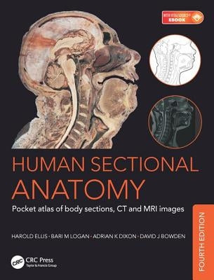 Human Sectional Anatomy: Pocket Atlas of Body Sections, CT and MRI Images, Fourth Edition by Logan, Bari M.