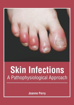 Skin Infections: A Pathophysiological Approach by Perry, Joanne
