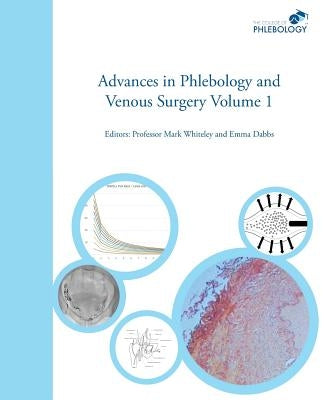 Advances in Phlebology and Venous Surgery Volume 1 by Whiteley, Mark Steven