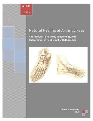 Natural Healing of Arthritic Feet: Alternatives To Fusions, Tenotomies, and Osteotomies in Foot & Ankle Orthopedics by Bernardin Phd, Charles P.