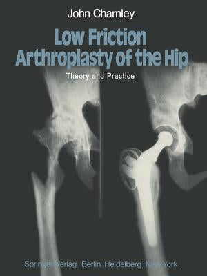 Low Friction Arthroplasty of the Hip: Theory and Practice by Charnley, J.
