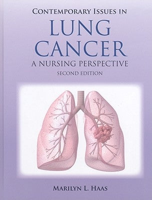Contemporary Issues in Lung Cancer: . by Haas, Marilyn