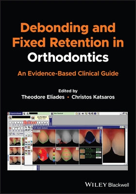Debonding and Fixed Retention in Orthodontics: An Evidence-Based Clinical Guide by Eliades, Theodore