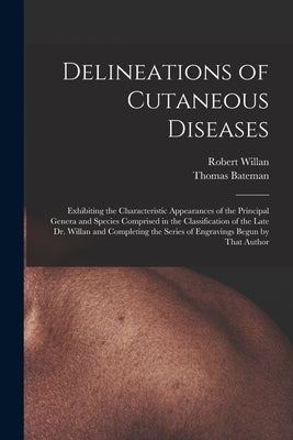 Delineations of Cutaneous Diseases: Exhibiting the Characteristic Appearances of the Principal Genera and Species Comprised in the Classification of t by Willan, Robert
