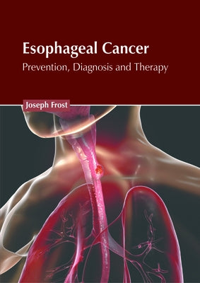 Esophageal Cancer: Prevention, Diagnosis and Therapy by Frost, Joseph