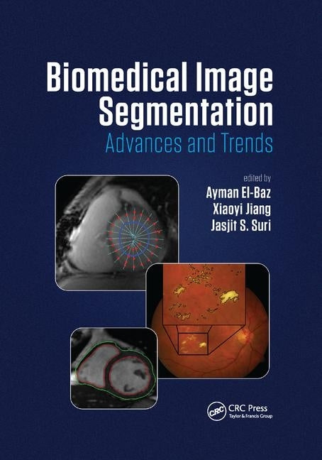 Biomedical Image Segmentation: Advances and Trends by El-Baz, Ayman