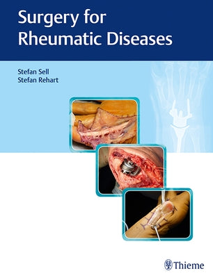 Surgery for Rheumatic Diseases by Sell, Stefan