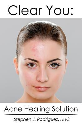 Clear You: Acne Healing Solution by Rodriguez Hhc, Stephen J.