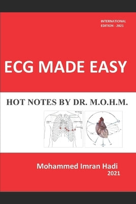 ECG Made Easy: Hot Notes by Dr. M.O.H.M. by Imran, Mohammed