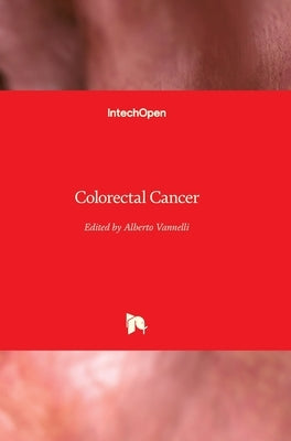 Colorectal Cancer by Vannelli, Alberto
