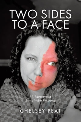 Two Sides to a Face: My Journey with Sturge Weber Syndrome by Peat, Chelsey