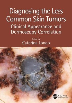 Diagnosing the Less Common Skin Tumors: Clinical Appearance and Dermoscopy Correlation by Longo, Caterina