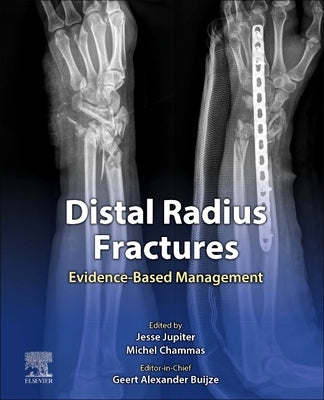 Distal Radius Fractures: Evidence-Based Management by Buijze, Geert Alexander