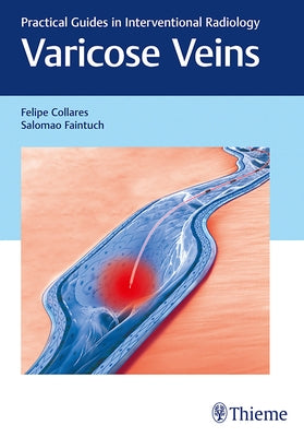 Varicose Veins: Practical Guides in Interventional Radiology by Collares, Felipe
