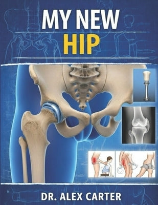 My New Hip: The Complete Guide to Hip Replacement Surgery, Recovery, Rehab, Pain Relief, Exercises, and Regaining Mobility by Carter, Alex