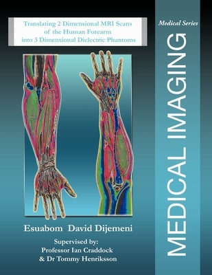 Medical Imaging: Translating 2 Dimensional MRI Scans of the Human Forearm into 3 Dimensional Dielectric Phantoms by Dijemeni, Esuabom