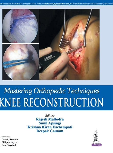 Mastering Orthopedic Techniques: Knee Reconstruction by Malhotra, Rajesh