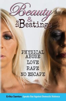 Beauty & the Beatings: Physical Abuse, Love, Rape no Escape. True story about Domestic Violence. by Santos, Erika