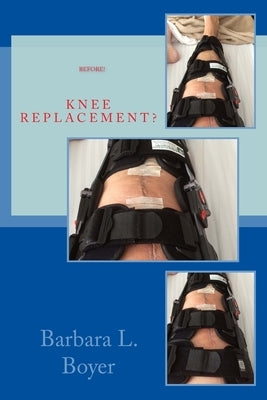Read This BEFORE Your Knee Replacement by Boyer, Barbara L.
