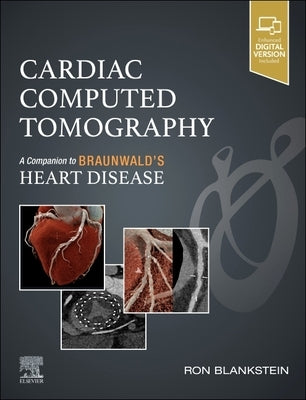 Cardiac Computed Tomography: A Companion to Braunwald's Heart Disease by Blankstein, Ron