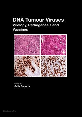DNA Tumour Viruses: Virology, Pathogenesis and Vaccines by Roberts, Sally