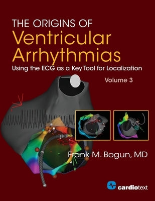 The Origins of Ventricular Arrhythmias, Volume 3: ECG as a Key Tool for Localization, Volume 3 by Bogun, Frank M.