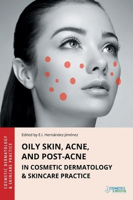 Oily Skin, Acne, and Post-Acne in Cosmetic Dermatology & Skincare Practice by Hernandez-Jimenez, Elena