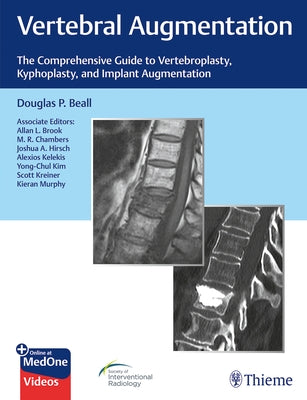 Vertebral Augmentation: The Comprehensive Guide to Vertebroplasty, Kyphoplasty, and Implant Augmentation by Beall, Douglas P.