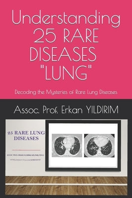 Understanding 25 RARE DISEASES - LUNG: Decoding the Mysteries of Rare Lung Diseases: What You Need to Know by Yildirim, Erkan Imp