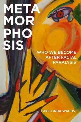 Metamorphosis: Who We Become After Facial Paralysis by Wachs, Faye Linda