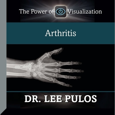 Arthritis by Pulos, Lee