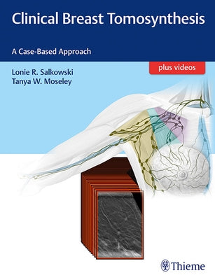 Clinical Breast Tomosynthesis: A Case-Based Approach by Salkowski, Lonie R.