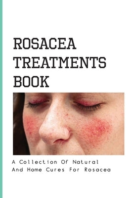 Rosacea Treatments Book- A Collection Of Natural And Home Cures For Rosacea: Rosacea Treatment by Diskind, Merlin
