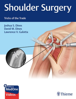 Shoulder Surgery: Tricks of the Trade by Dines, Joshua