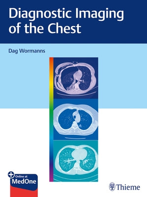 Diagnostic Imaging of the Chest by Wormanns, Dag
