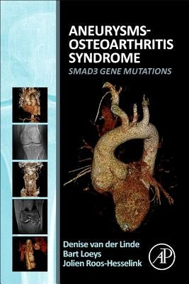 Aneurysms-Osteoarthritis Syndrome: Smad3 Gene Mutations by Van Der Linde, Denise