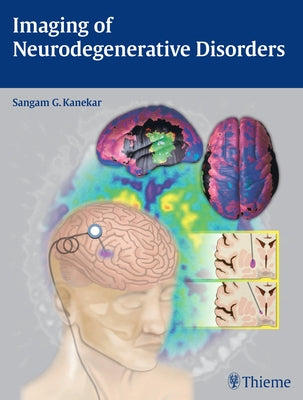 Imaging of Neurodegenerative Disorders by Kanekar, Sangam