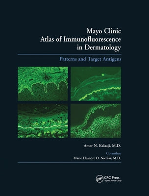 Mayo Clinic Atlas of Immunofluorescence in Dermatology: Patterns and Target Antigens by Kalaaji, Amer N.