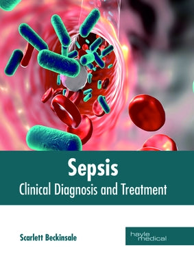 Sepsis: Clinical Diagnosis and Treatment by Beckinsale, Scarlett