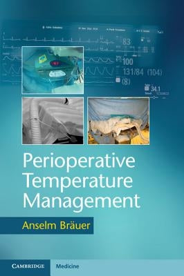 Perioperative Temperature Management by Bräuer, Anselm