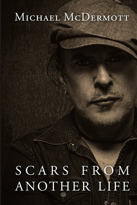 Scars From Another Life: A Memoir by Krazit, Jen