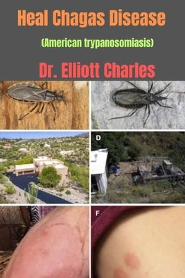 Heal Chagas Disease (American trypanosomiasis) by Charles, Elliott