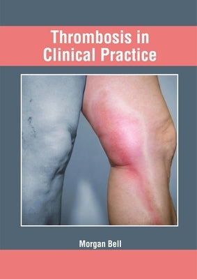 Thrombosis in Clinical Practice by Bell, Morgan