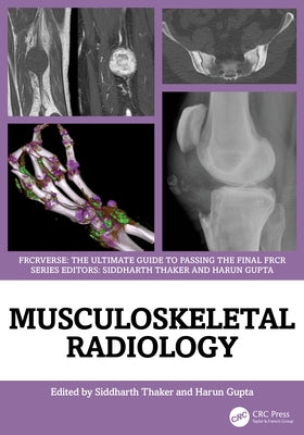 Musculoskeletal Radiology: An Ultimate Guide to Passing the Final FRCR by Thaker, Siddharth
