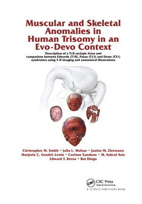 Muscular and Skeletal Anomalies in Human Trisomy in an Evo-Devo Context: Description of a T18 Cyclopic Fetus and Comparison Between Edwards (T18), Pat by Diogo, Rui