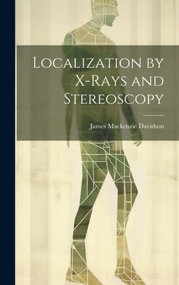 Localization by X-Rays and Stereoscopy by Davidson, James MacKenzie