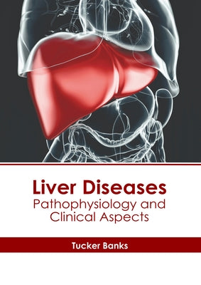 Liver Diseases: Pathophysiology and Clinical Aspects by Banks, Tucker