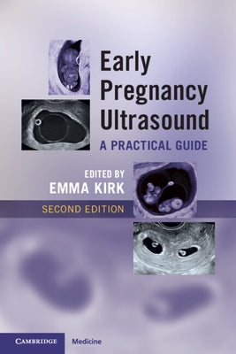 Early Pregnancy Ultrasound: A Practical Guide by Kirk, Emma