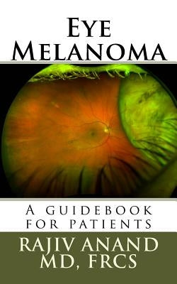 Eye Melanoma: A manual for patients by Anand MD, Rajiv